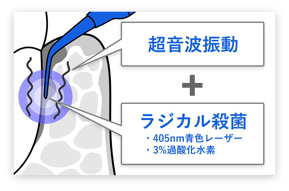 ブルーラジカル